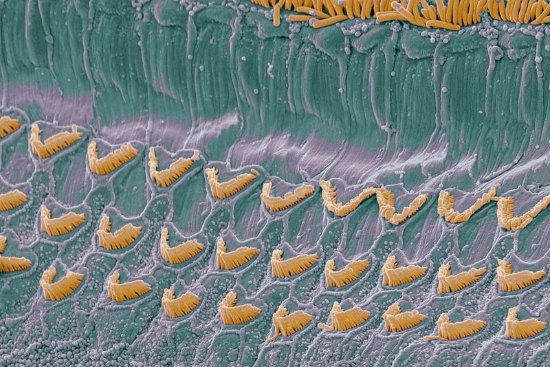 Cochlear outer hair cells