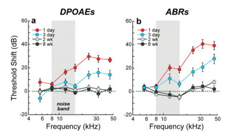 Tinnitus and hearing damage