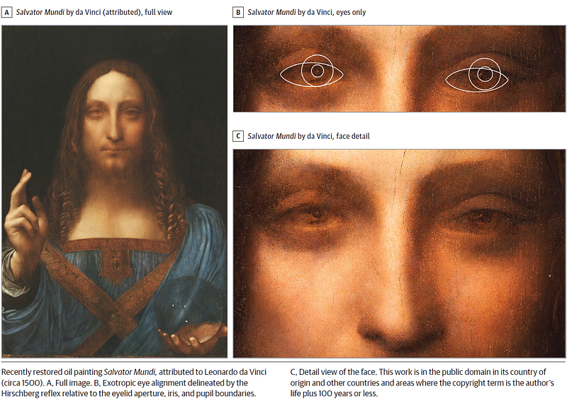 Illustration of vision concepts related to da Vinci